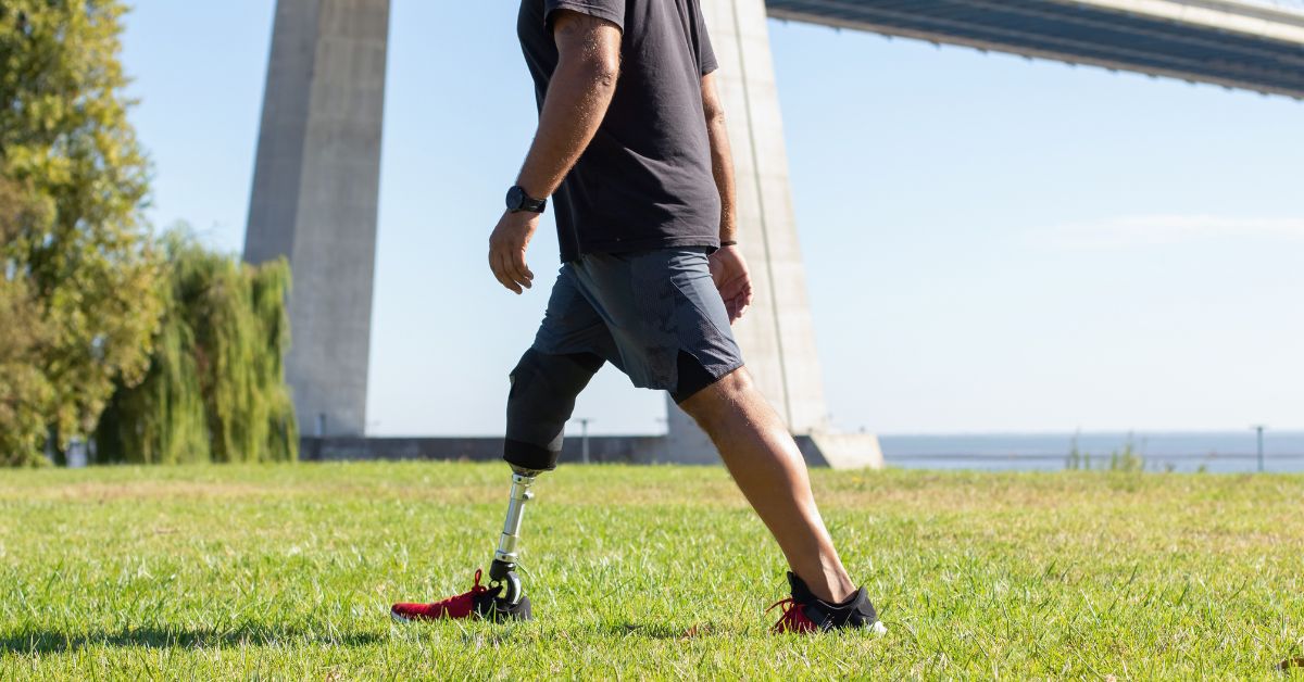 How to Walk with a Prosthetic Leg A Step by Step Guide 1