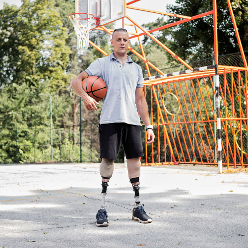 Basketball Prosthetics