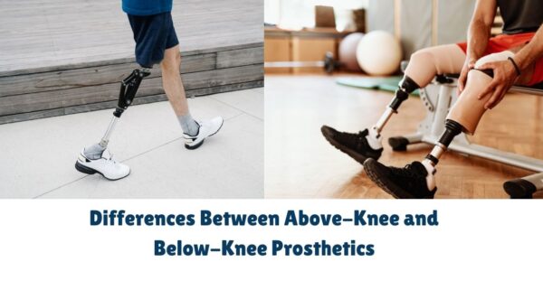 Differences Between Above-Knee and Below-Knee Prosthetics