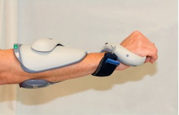 Spinal Cord Injury and Its Orthotic Management 14 Functional Electrical Stimulation (FES) & Neuroprosthetics