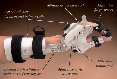 Spinal Cord Injury and Its Orthotic Management 18 Wrist-driven orthosis (tenodesis splint)