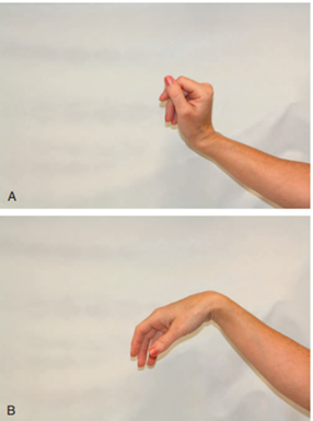Spinal Cord Injury and Its Orthotic Management 6 range of motion (ROM) exercises