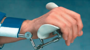 Spinal Cord Injury and Its Orthotic Management 20 Dynasplint System