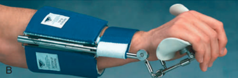 Spinal Cord Injury and Its Orthotic Management 20 Dynasplint System