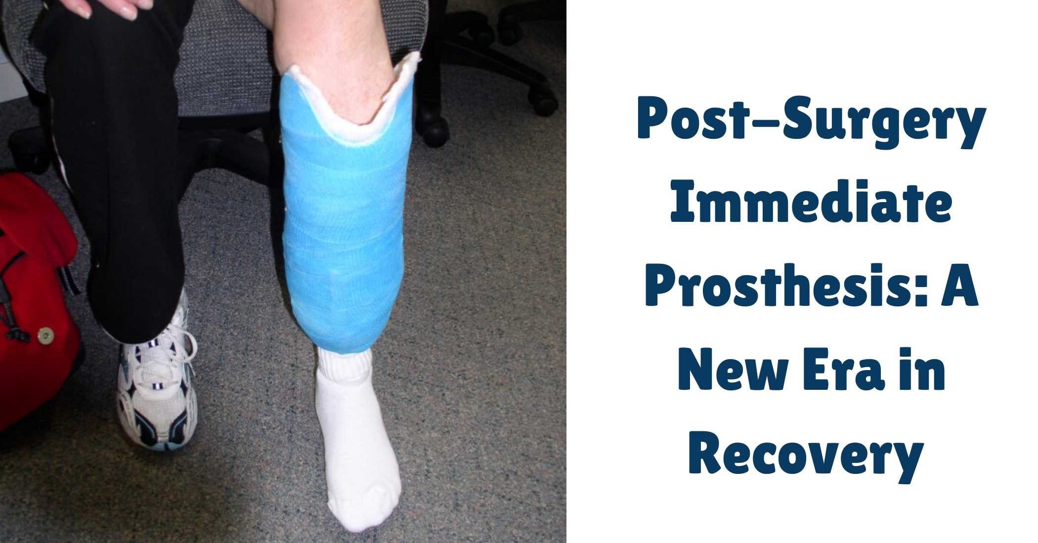 Blogs 5 Post-Surgery Immediate Prosthesis: A New Era in Recovery
