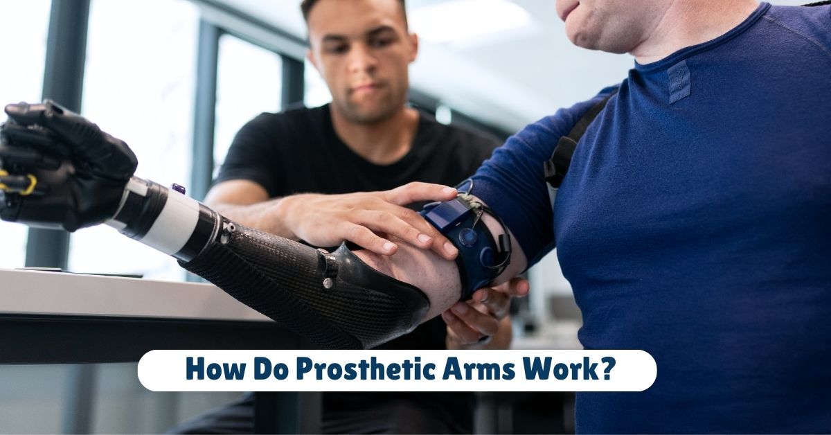 How Do Prosthetic Arms Work? 1 How Do Prosthetic Arms Work?
