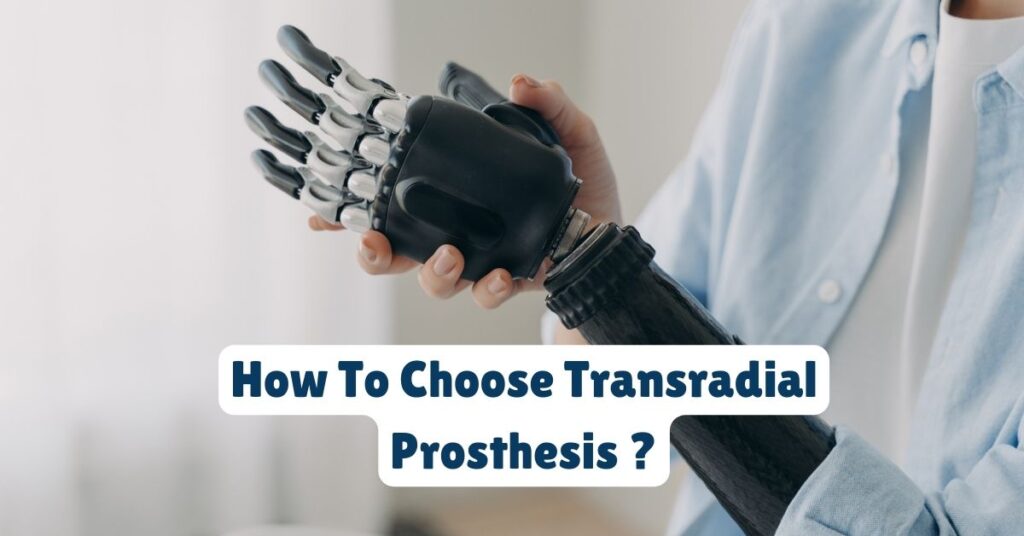 How To Choose Transradial Prosthesis: What You Need to Know