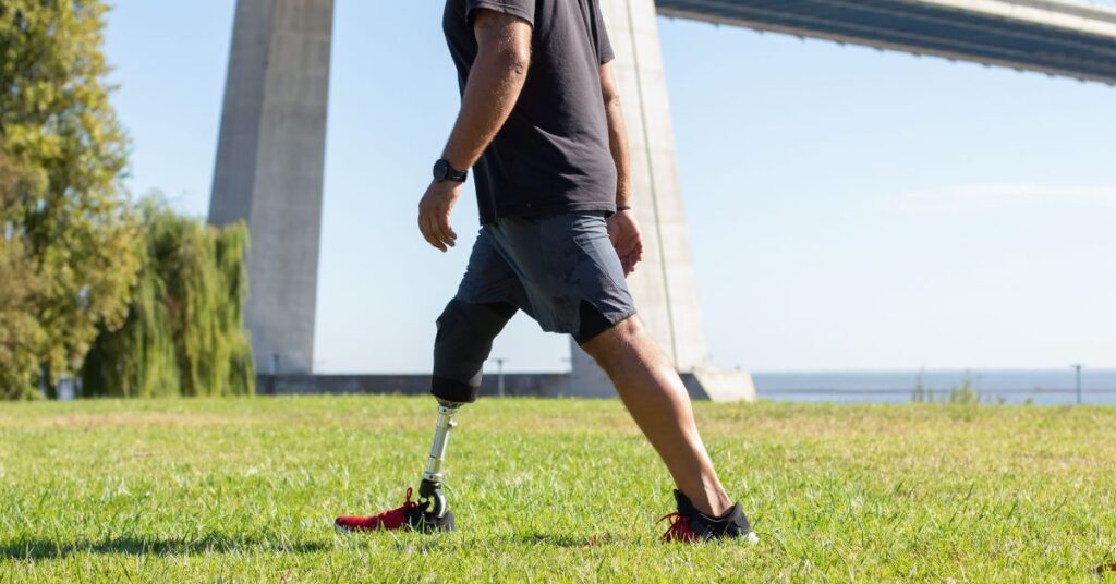 How to Walk with a Prosthetic Leg: A Step-by-Step Guide